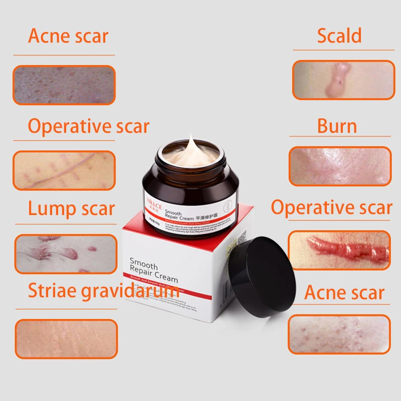 

Nillce body care cream 50g scar removal cream repair acne scar stretch marks skin care cream moisturizing smooth face cream
