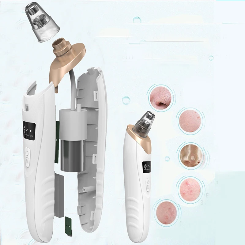 

MAKEGINA Blackhead Remover Cleaner Pore Vacuum Remove Blackheads Deep Clean Black Head Acne Pimple Removal Tool Face Cleaning