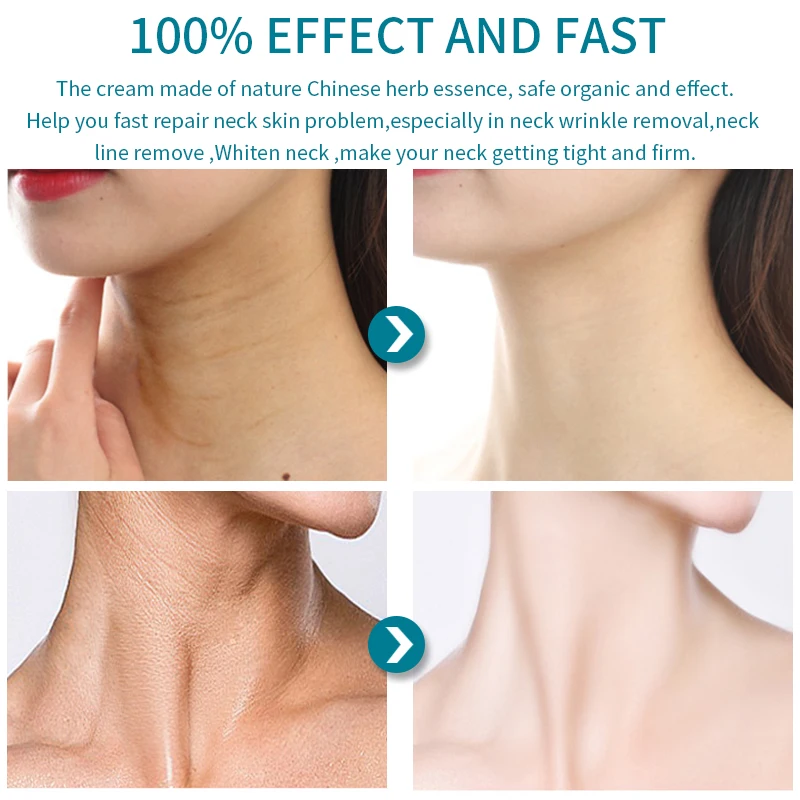 HEMEIEL крем для шеи против старения отбеливания ухода за кожей увлажняющий