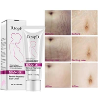 mango remove pregnancy acne scar stretch mark cream treatment maternal anti aging repair anti wrinkle firming body cream