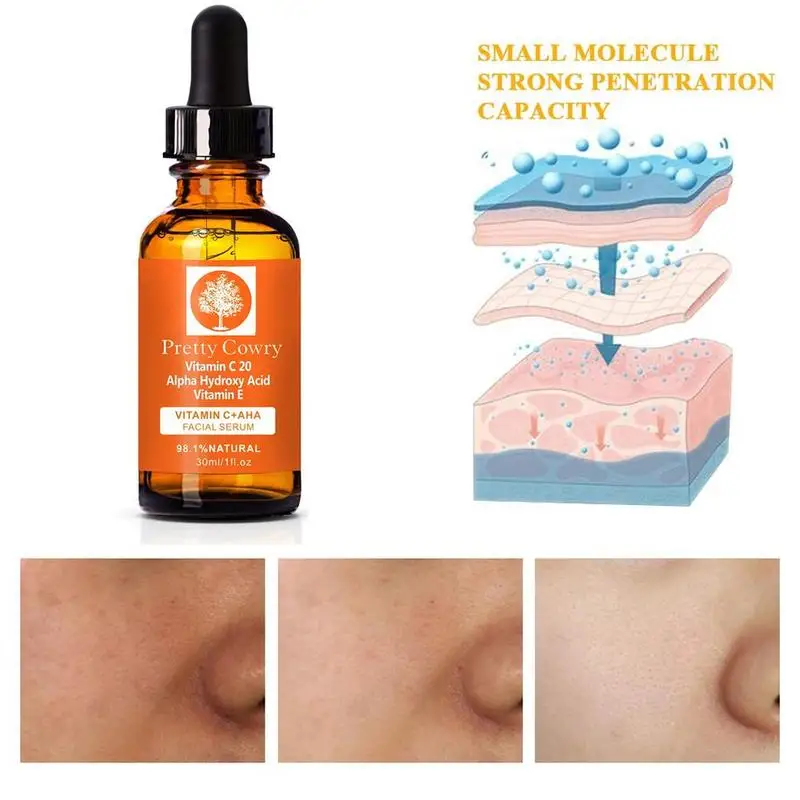 30 мл кислота анти удалить парк Спрингс аккор Pretty/кожу гиалуроновой витамин уход