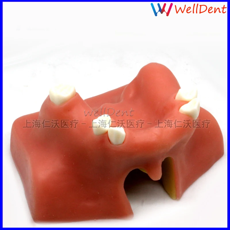 

Dental Teeth Model Implant Training Model Oral Implant Maxillary Sinus Lifting Exercises Training Practice Model