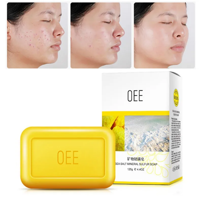 Сульфатное мыло Шанхай 4 условия кожи от акне, псориаза Себорея Eczema противогрибковый парфюм масло пузырь ванна здоровые мыла 84 г