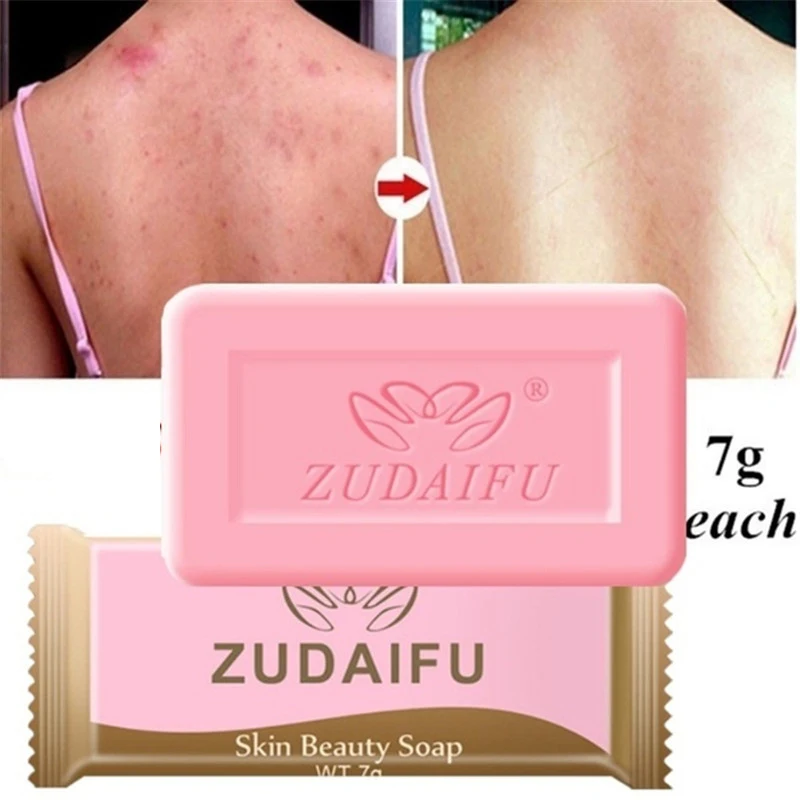 5pcs Brand Sulfur Soap Anti-mites Anti-acne Body Cleansing Soap Skin Treatment Acne Psoriasis Seborrhea Eczema Anti Fungus TTCC