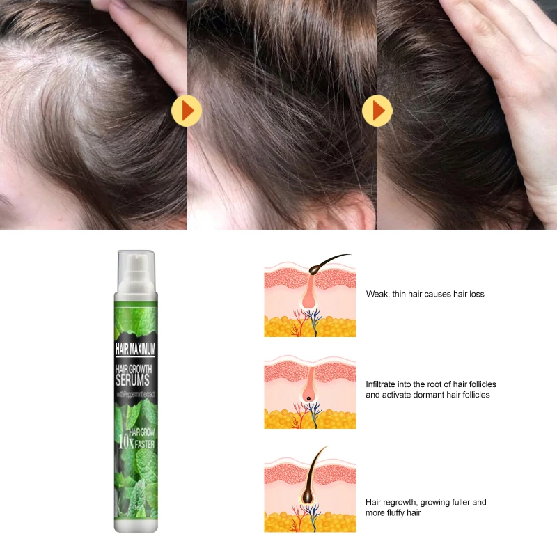 Effective Hair Growth Serum Spray Fast Thick For Prevent Loss Damaged Repair Natural Care Products TSLM1 | Красота и здоровье