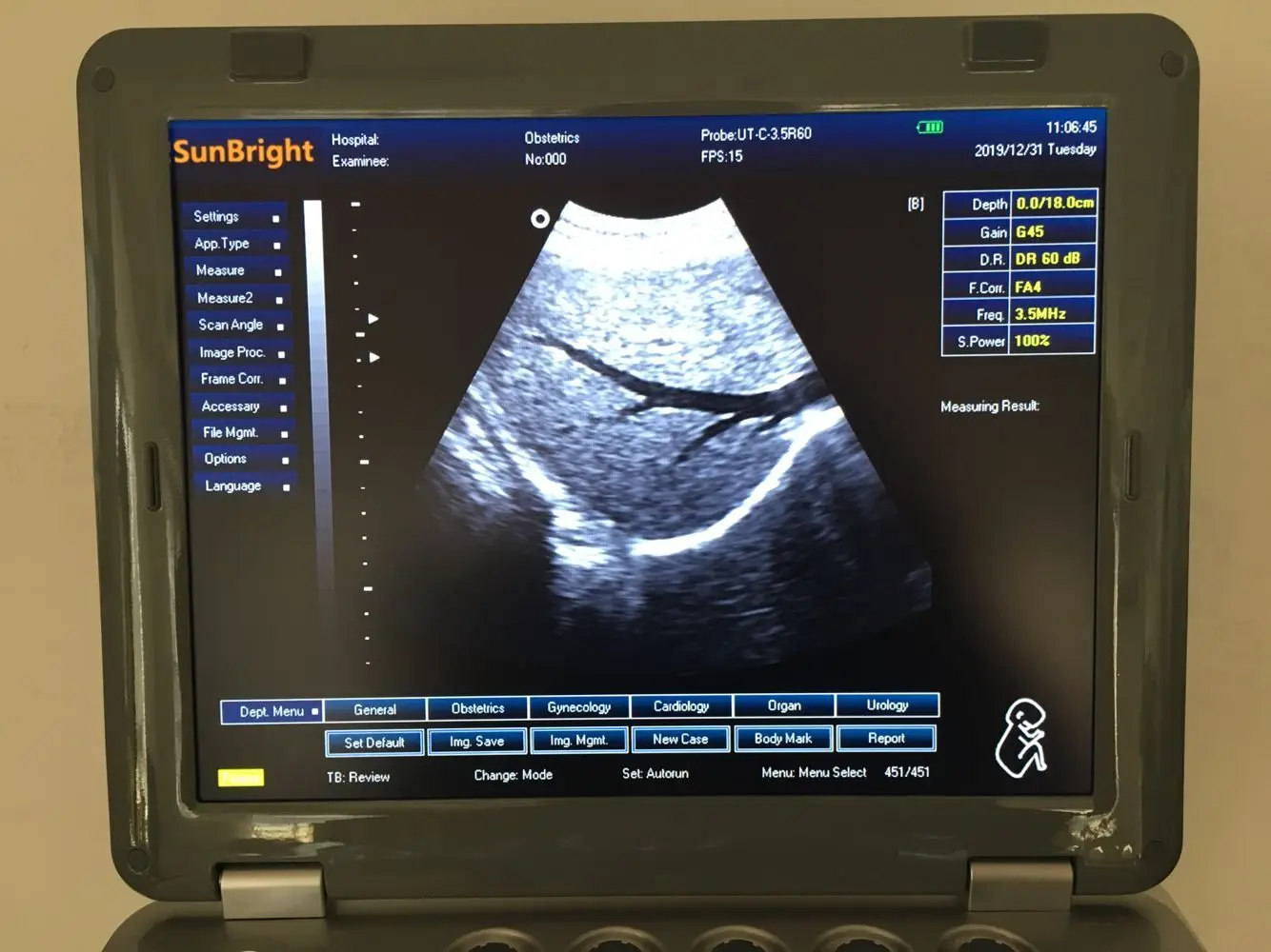 SUN-800D медицинские ультразвуковые инструменты mindray dp 10 3D ультразвуковая машина