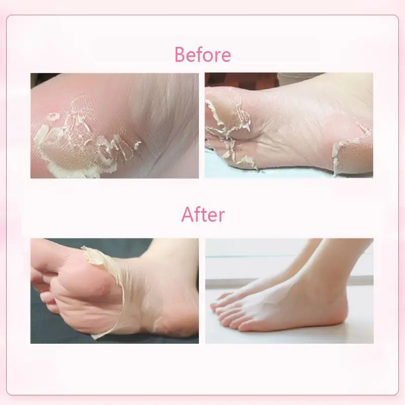 2 шт. Новая маска для удаления омертвевшей кожи отшелушивающая ног крем ухода за
