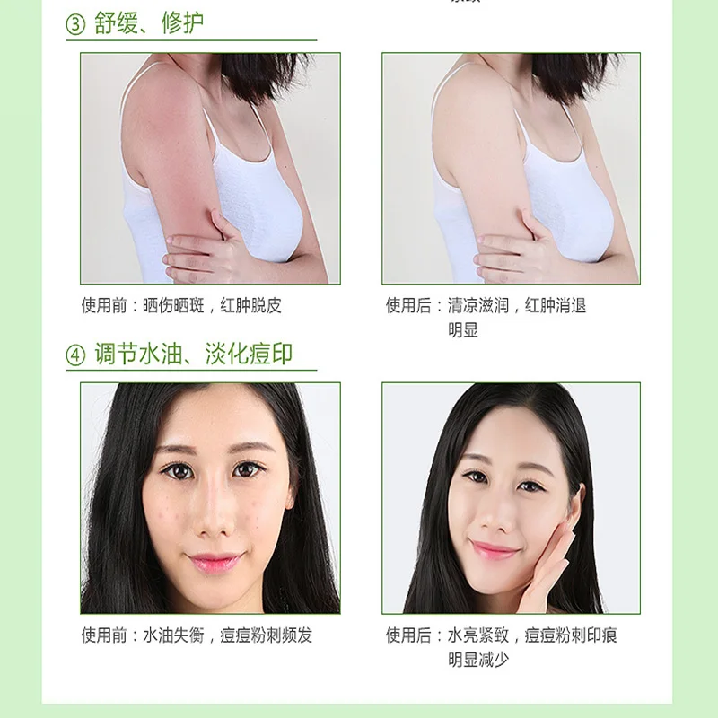 

Concentrated aloe vera soothing gel cream after sun repair moisturizing whitening moisturizing skin moisturizing aloe gel