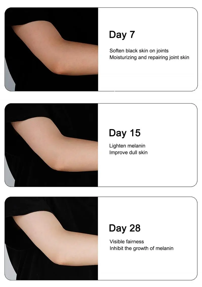 Отбеливающий массажный крем черные суставы колени меланин черный для тела
