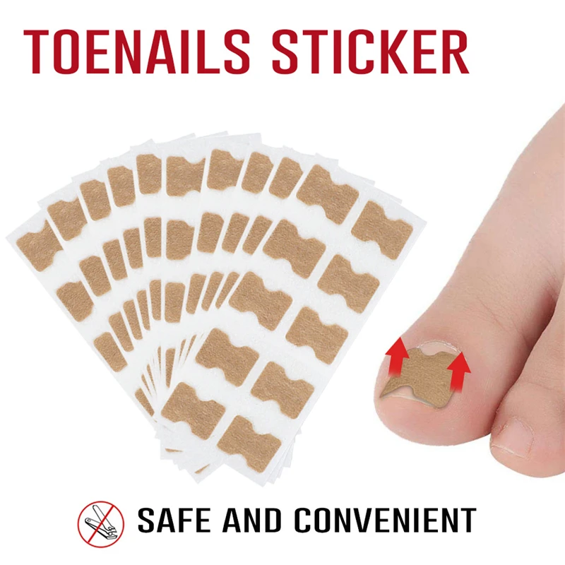 

Nail Correction Tape Nail Ingrown Nail Corrector Toenail Patch
