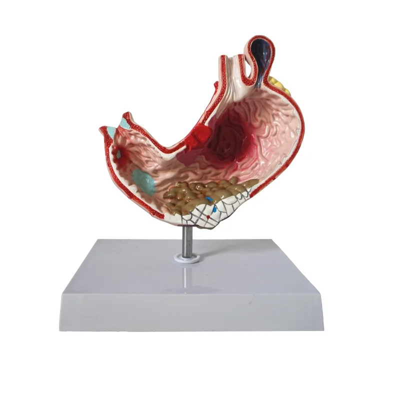 Анатомия человеческого желудка медицинская патология гастрит язва