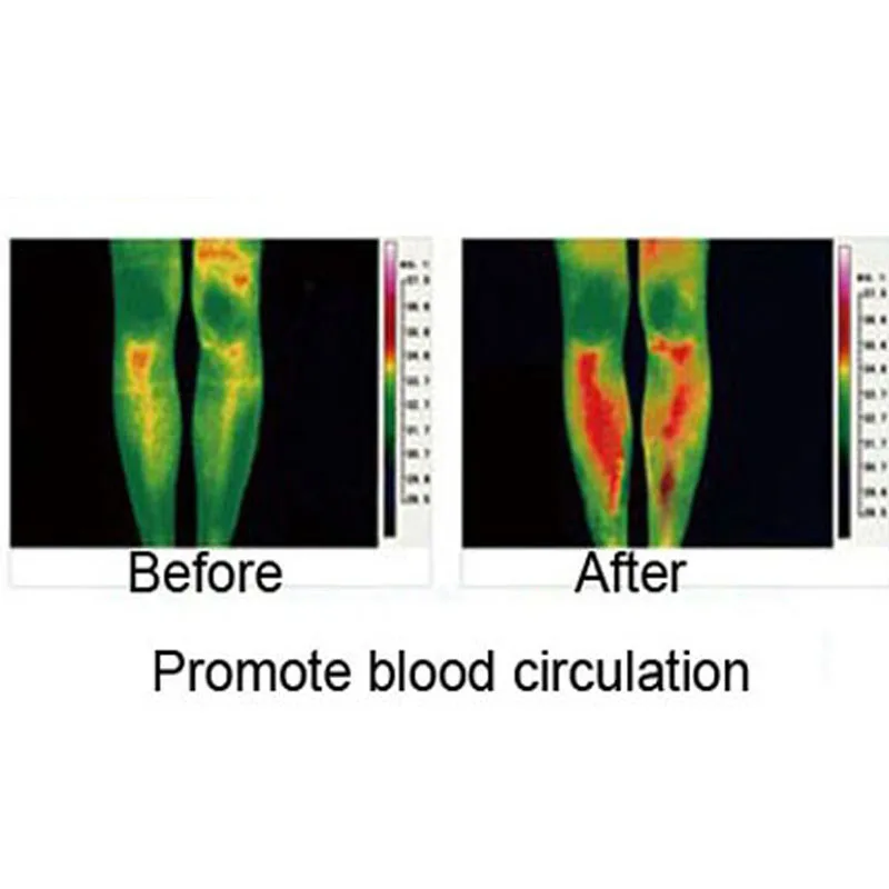 1 пара турмалиновая повязка на колено колодки для магнетической терапии с