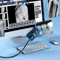 dental sensor dynimage x ray intra port digital transmission system hd image for dentists and veterinarians