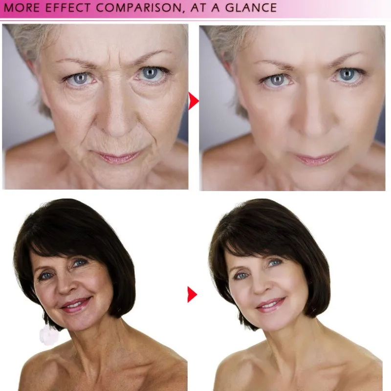 20ml Pregnant Woman Hyaluronic Acid Collagen Face Serum Anti Wrinkle Acne Treatment Essence Whitening Anti-Aging Facial |