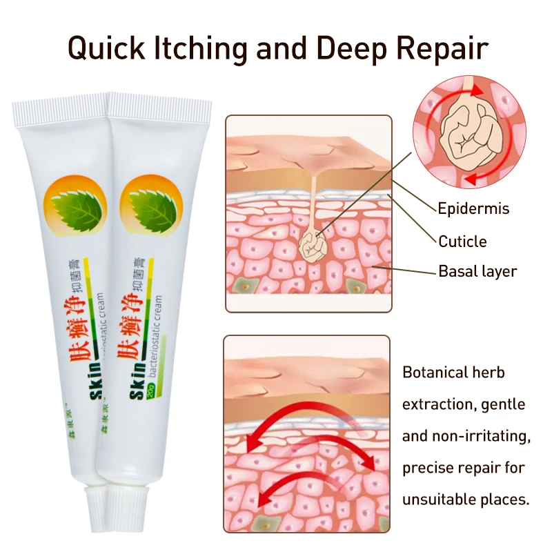 3 шт. антибактериальный крем для лечения псориаза экзема | Красота и здоровье