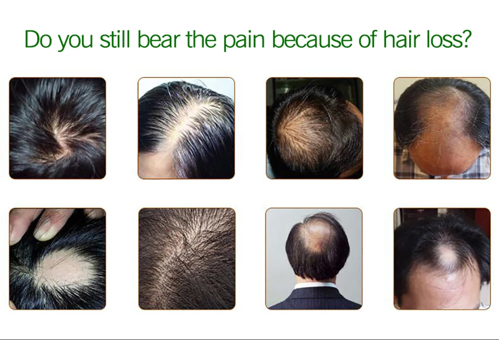 Эфирное масло для ухода за волосами 30 мл 7 дней эфирное сухих поврежденных волос |