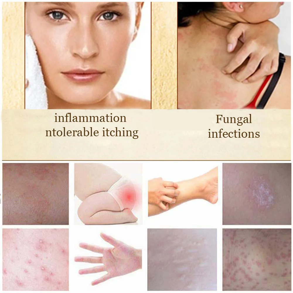 

7g Anti-mite Soap Sulfur Soap Oil-control Acne Treatment Cleaner Moisturizing Skin Care Anti Fungus Soap Portable Clean TSLM1