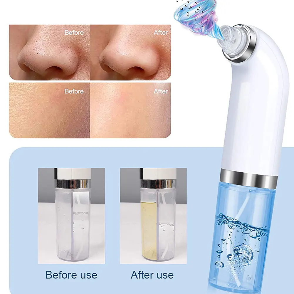 

Electric Facial Cleanser Vacuum Suction Blackhead Remover Deep Facial Cleansing Machine Nose Acne Cleaner Pore Pimple Remover