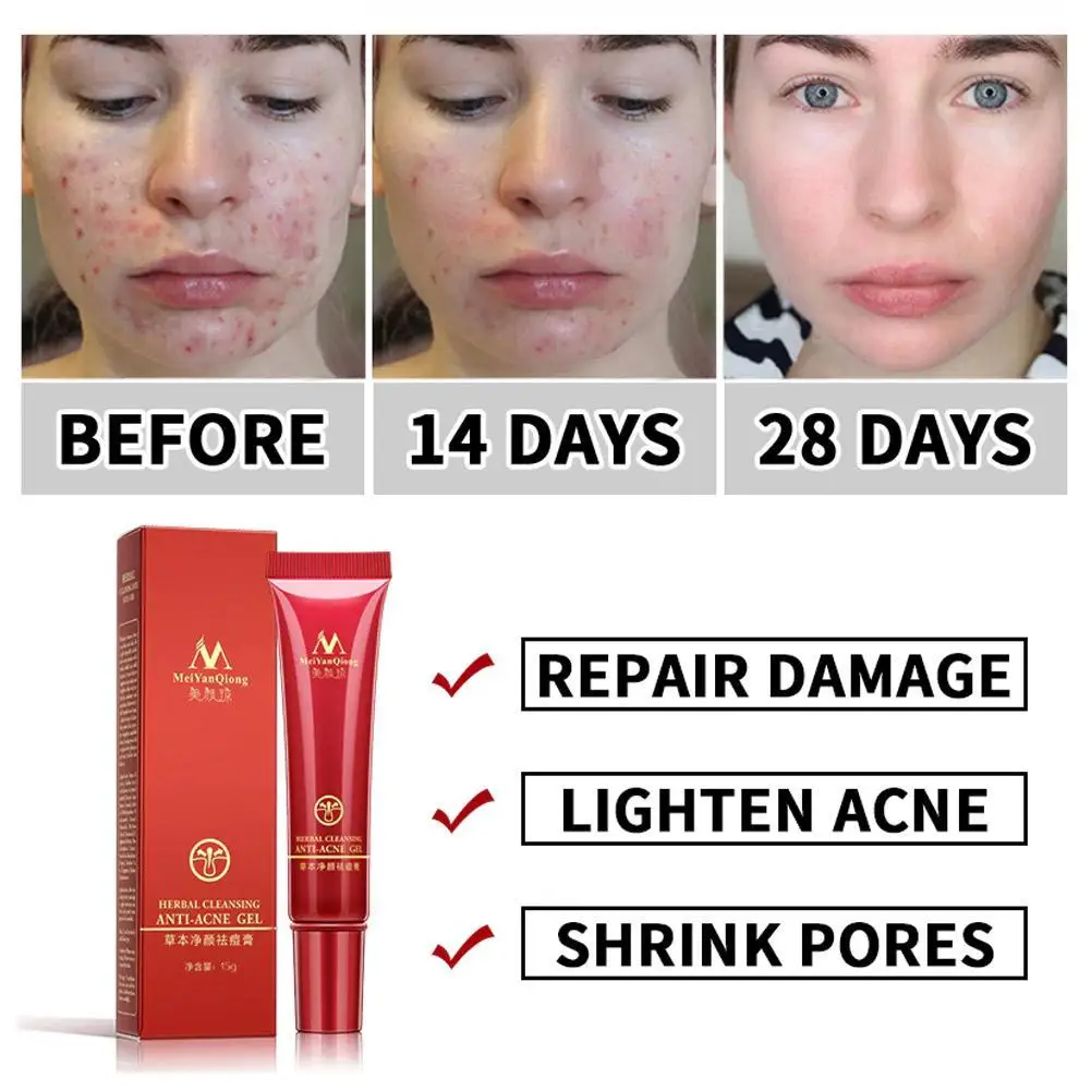 15 мл уход за кожей лица акне очищающий крем по уходу для удаления ремонт