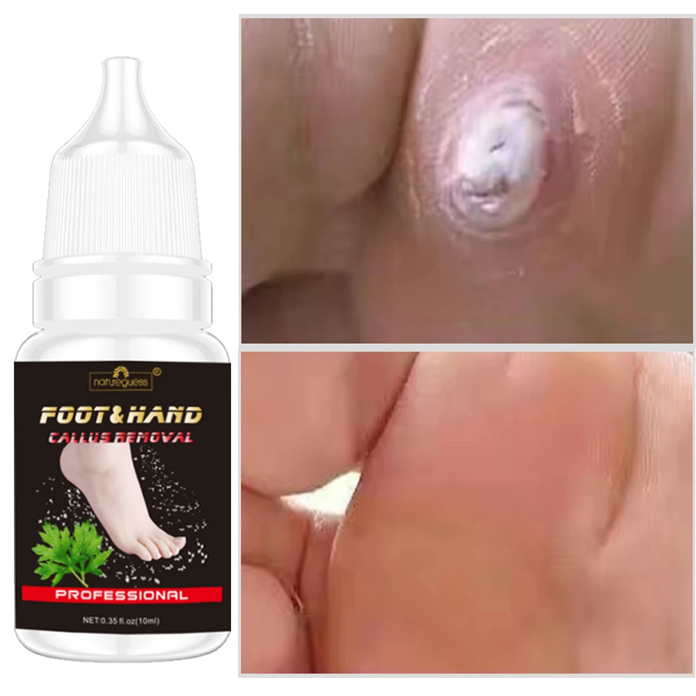 Отшелушивающая Маска-пилинг для ног мозоли ороговелости удаления омертвевшей