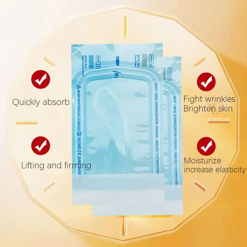 Рисунок 4 - 400 мешков, радар-нить