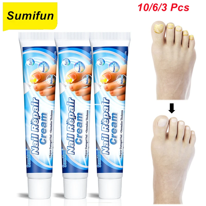

10/6/3 Pcs Nail Repair Cream Treat Onychomycosis Paronychia Fungus Ointment Toe Finger Antibacterial Nail Medical Plaster