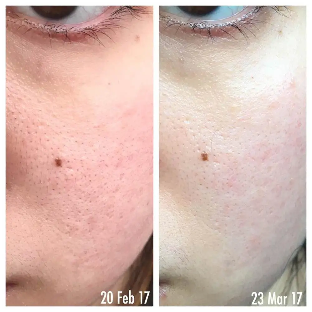 Тоник для лица Pixi Skintreats 5% тоник с гликолевой кислотой сыворотка против старения