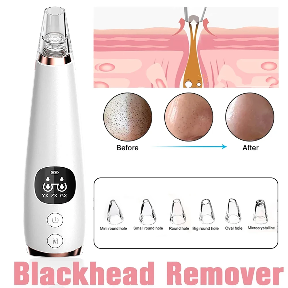 Мощный пылесос для удаления чёрных точек и прыщей | Красота здоровье