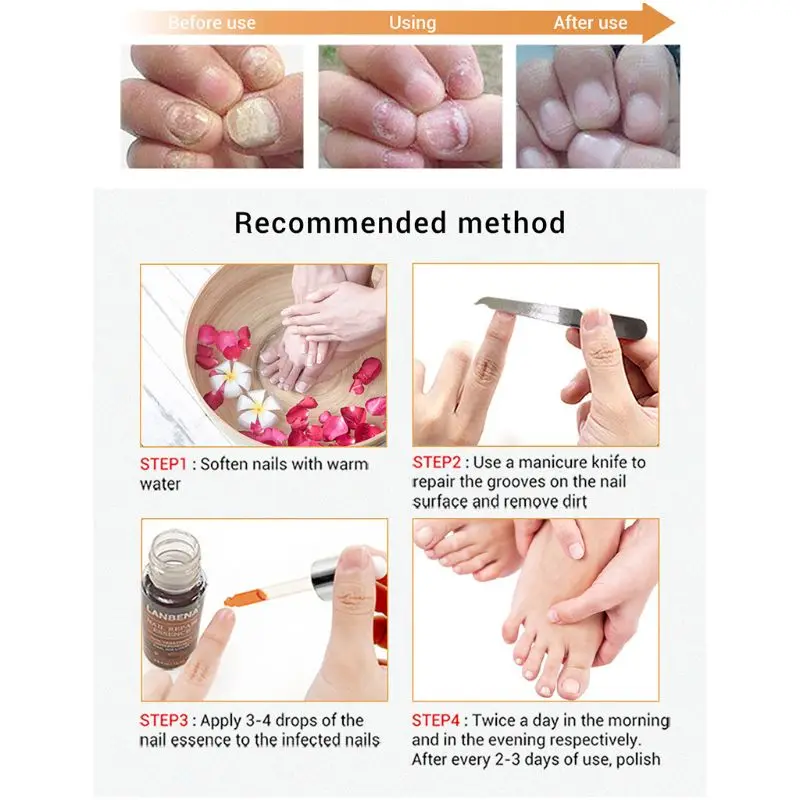 

12ml Nail Repair Essence with File Fungal Removal Serum Onychomycosis Treatment 875C