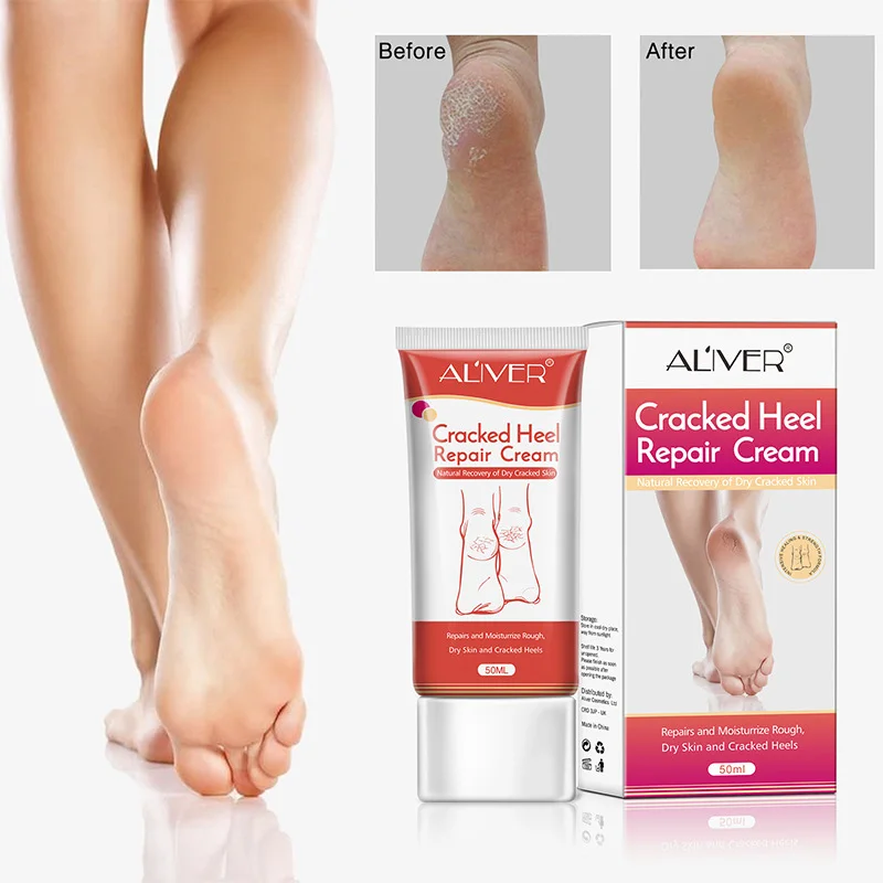 

Foot Cream Whitening Moisturizing Treatment Hydrating Smooth Foot Skin Care @ME88