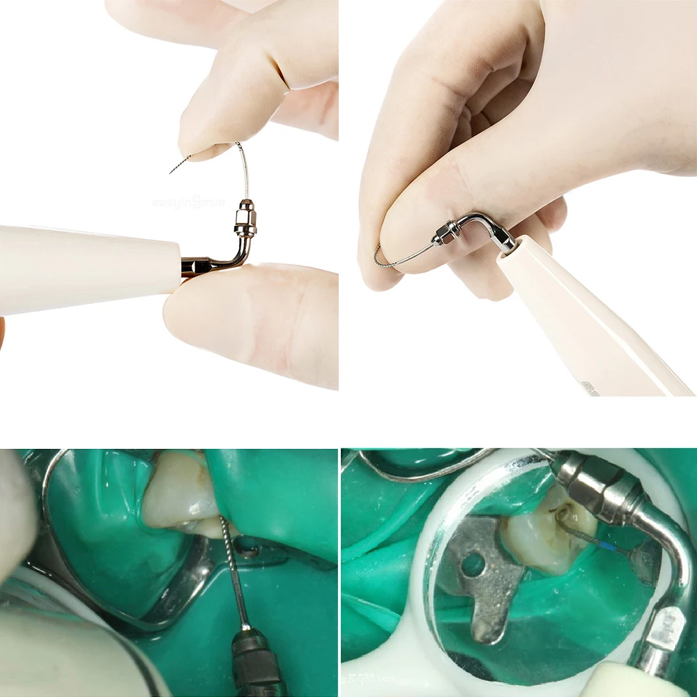 6 шт. в бутылке стоматологические U-файлы эндодонтические файлы для корневых