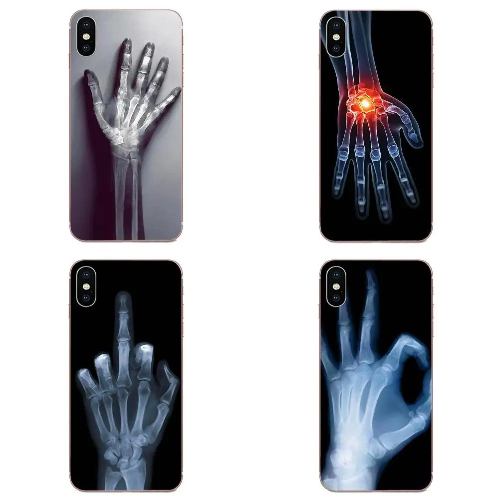 Мягкие чехлы для samsung Galaxy Note 5 8 9 S3 S4 S5 S6 S7 S8 S9 S10 5G mini Edge Plus Lite Wolverine X ray Hands Bones