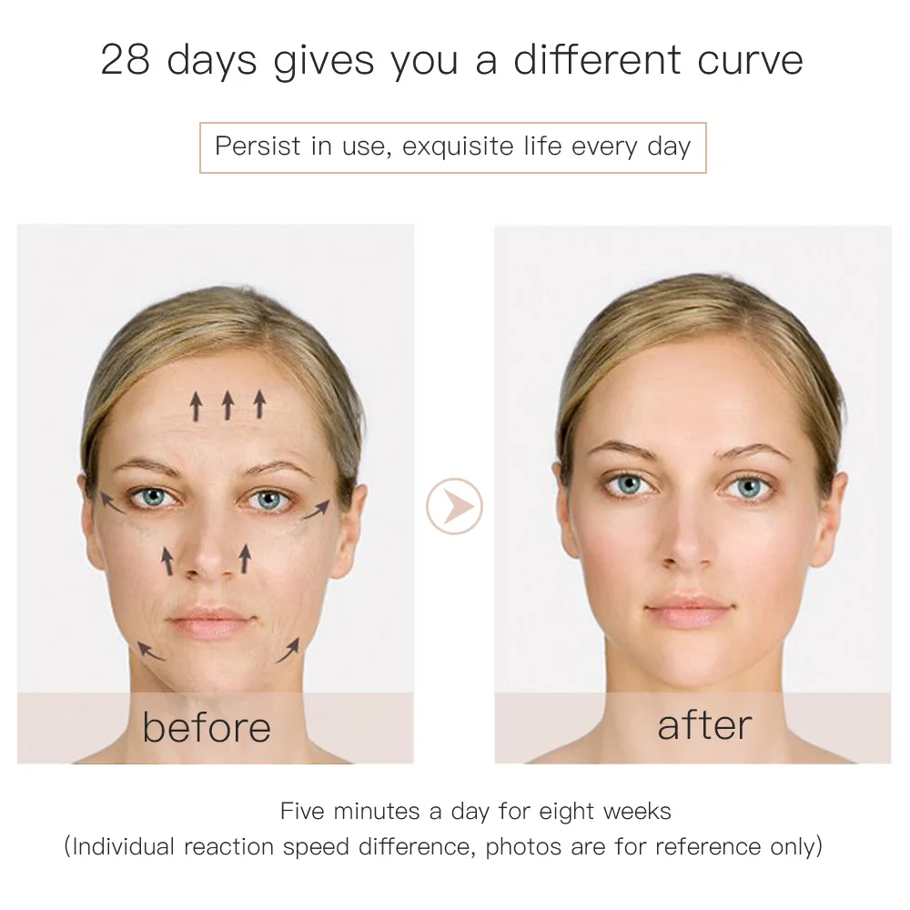 Роликовый массажер для лифтинга лица микротоками EMS подтяжки кожи против