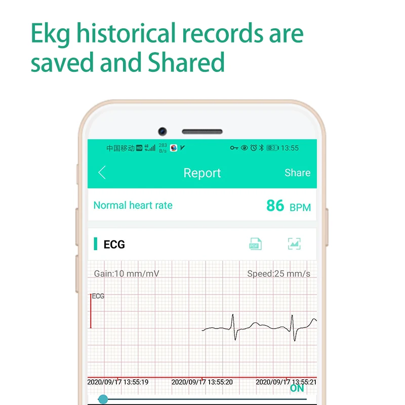 Монитор ЭКГ беспроводной с приложением для iOS и Android | Красота здоровье
