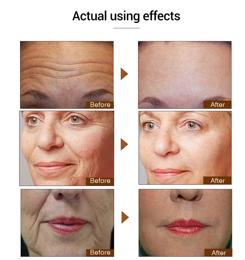 Увлажняющая сыворотка для лица efero восстанавливающая с шестью пептидами против