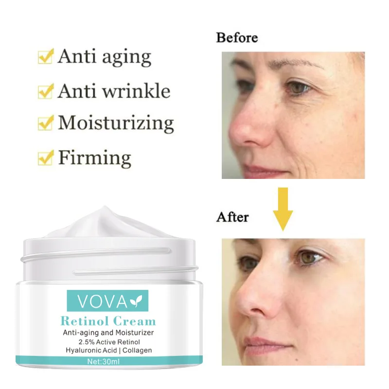 VOVA Retinol Anti Wrinkle Face Cream Collagen Hyaluronic Acid Shrink Pores Firming Improve Puffiness Moisturizing Skin Care | Красота и