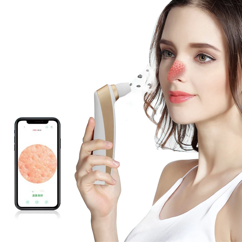 

Portable USB Electric Pore Shrink Visual Black Head Vacuum Remover Machine