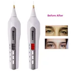 Ручка плазменная для подтяжки век, удаления пятен, татуировок, родинок, подтяжка кожи лица