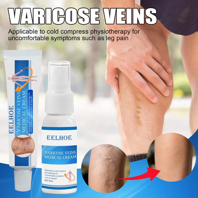 

Varicose Vein Ointment, Vasolitis Ointment, Phlebitis, Spider Cream, Angitis Removal, Medicinal Herbs, Plaster
