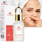 Экстракт акне MeiYanQiong центеллы азиатской, удаляет рубцы от акне, контролирует жирность и улучшает отбеливание кожи лица, 10 мл