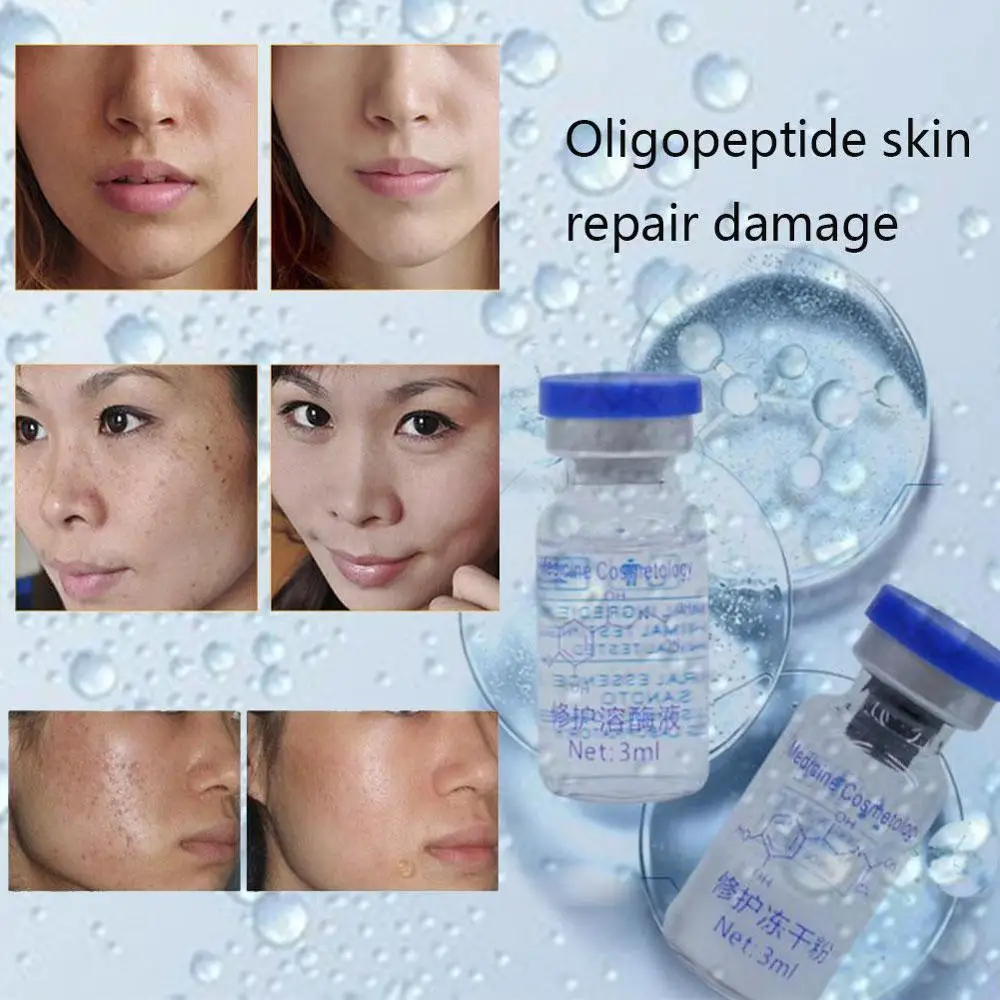 Original 1 Set Lyophilized Epidermal Growth Factor Scars Acne Serum Treatment Products Wrinkles Pimples Skin rhEGF Powder C Z5B9