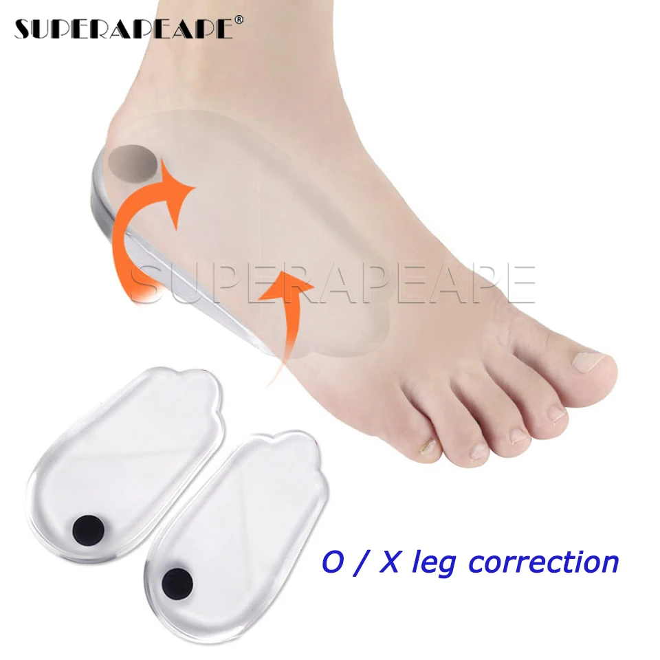 Magnetic Massage Insoles Gel O/X Type Leg Orthotics Heel Pads Corrective Valgus Varus Foot Magnet Insert | Спорт и развлечения