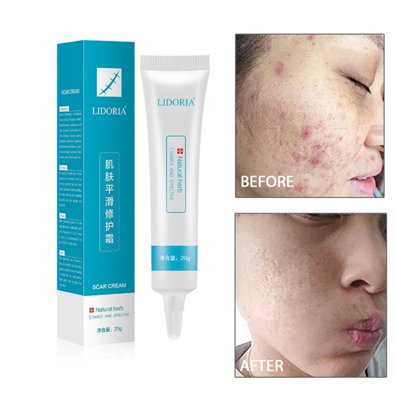 Skin Smoothing Cream Repair Essential Liquid Hydrating Remove Pimple Marks Skin Care Serum 20g