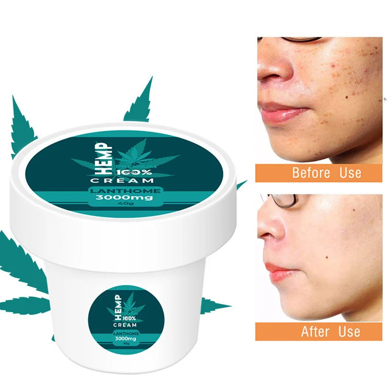 

LANTHOME Anti Wrinkle Face Cream Acne Treatment Shrink Pores Remove Blackhead Essence Anti Aging Smooth Fine Line Body Face Care