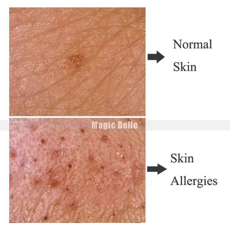 

2 in 1 skin analyzer skin tester hair analyzer scanner analyze skin condition and hair healthy for spa and hair salon use