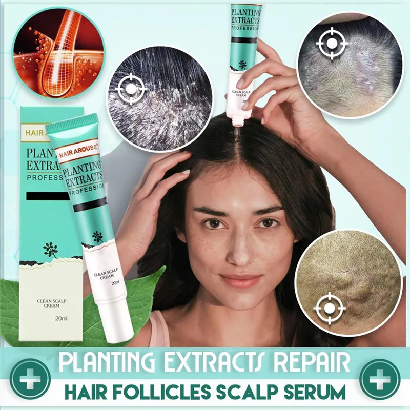 

Planting Extracts Repairs Hair Follicles Scalp Serum Get Lasting Relief from Itching, Flaking and Various Scalp Problems 20ml