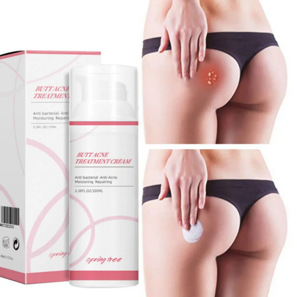 

Hot Sell Buttock Acne Cream Moisturizing And Softens Skin Repair Body Care Hip Pimples Treatment 100g New