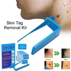 Медицинская Non токсический кожу средство удаления бирок инструмент для взрослых моль для борьбы с пигментацией, Лечение Уход за кожей набор инструментов с очистительные тампоны дома Применение