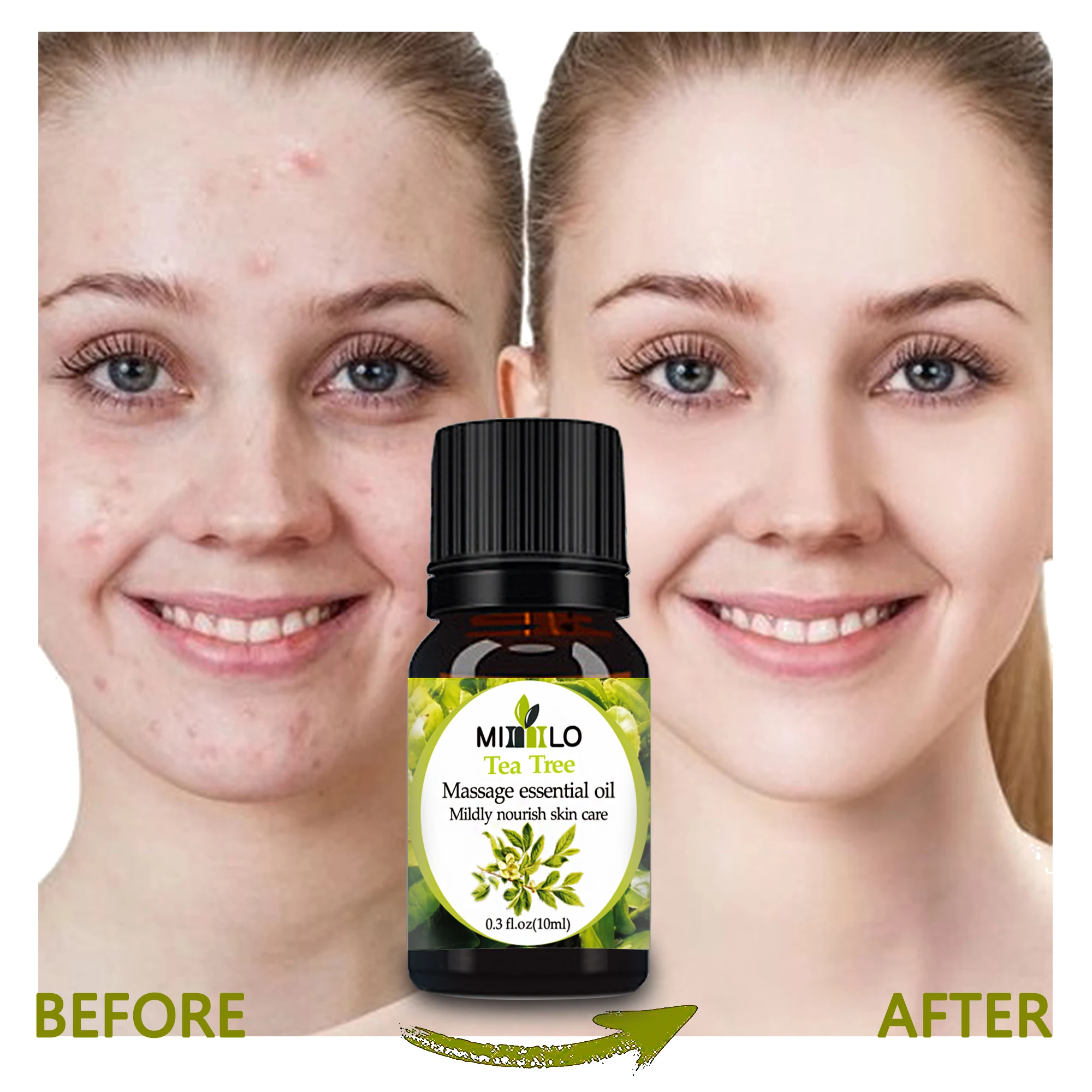 Эфирное масло чайного дерева экстракт от морщин Acne100 % чистое натуральное для