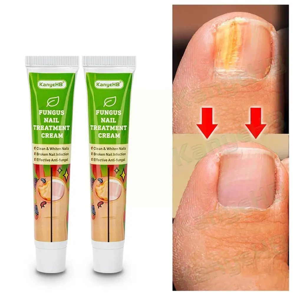 

Мазь для ухода за ногтями, 20 г